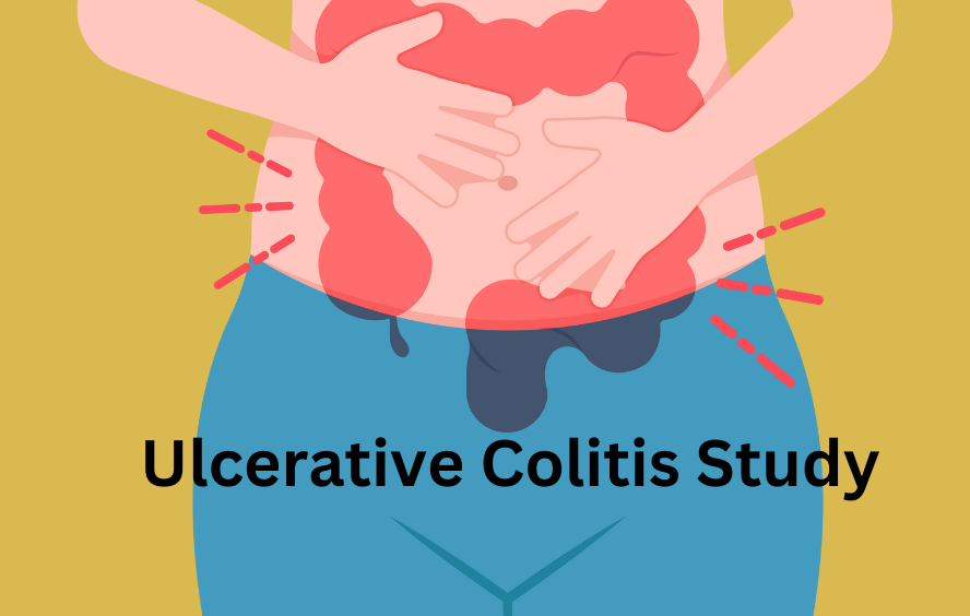 University of Glasgow seeking volunteers with Ulcerative Colitis